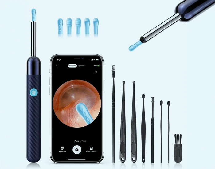 ear wax removal